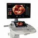 УЗД система з високим рівнем автоматизації Voluson S8 Touch GE Healthcare Voluson S8 фото 3