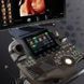 УЗД система з високим рівнем автоматизації Voluson S10 GE Healthcare Voluson S10 GE фото 6