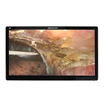 Медицинский Монитор Beacon S3282P 31,5" 4K UHD S3282P фото