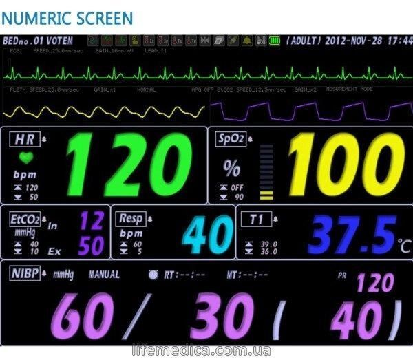 Багатофункціональний монітор пацієнта VP-1000 +копапнограф + принтер VP 1000 фото