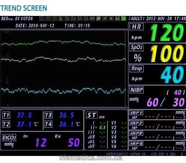 Багатофункціональний монітор пацієнта VP-1000 +копапнограф + принтер VP 1000 фото