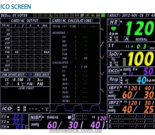 Багатофункціональний монітор пацієнта VP-1000 +копапнограф + принтер VP 1000 фото