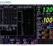 Багатофункціональний монітор пацієнта VP-1000 +копапнограф + принтер VP 1000 фото 10